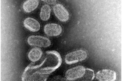 OPTIMISATION OF THE PROTOCOL FOR VIRAL METAGENOMICS