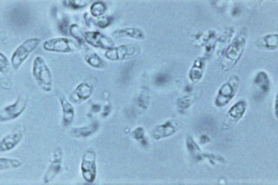 SPECIES DIVERSITY IN SARCOCYSTIS