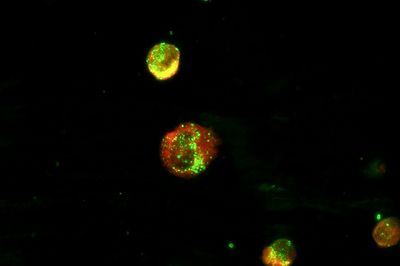 Bartonelóza - Bartonella henselae