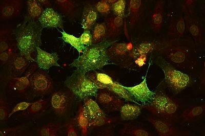 Infekční rinotracheitida - herpesvirus (FHV)