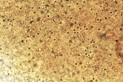 Genetická variabilita rodu Cryptosporidium