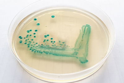 NRL for Escherichia coli